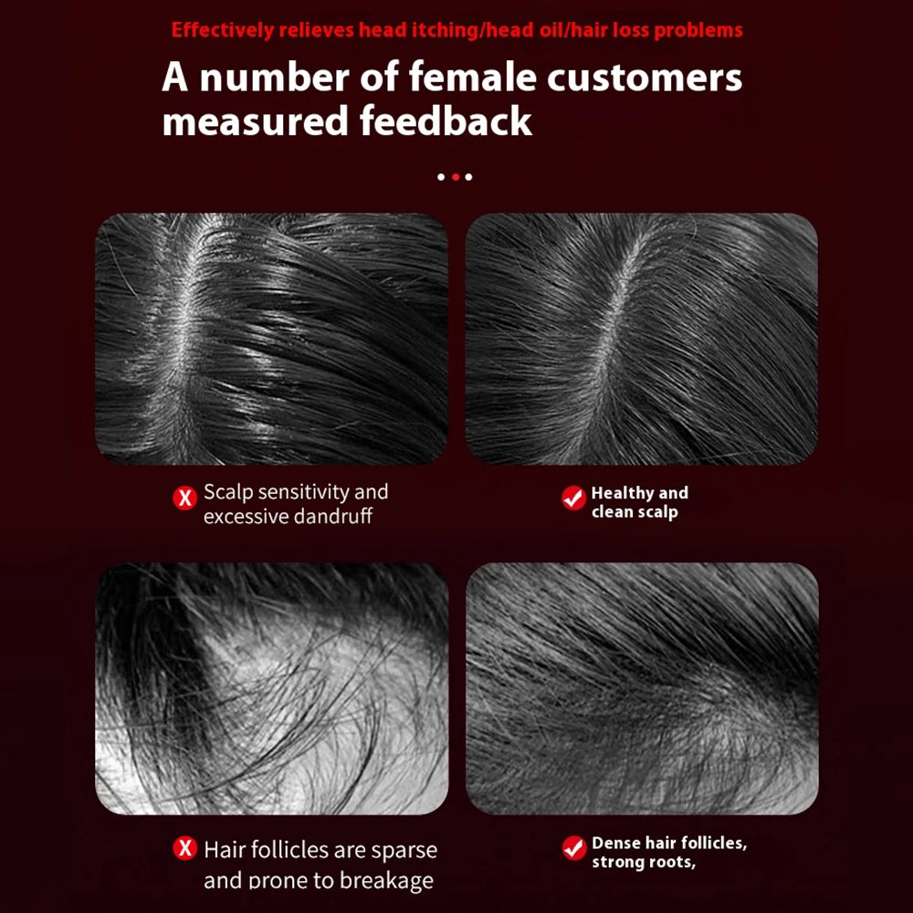 Electric Head Massager