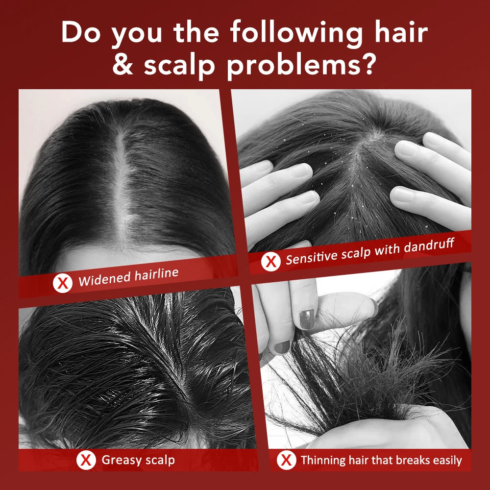 Electric Head Massager